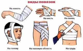 ЖЕСТКИЕ ПОВЯЗКИ