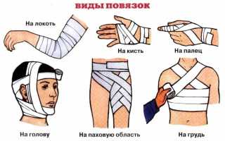 ТЕХНИКА НАЛОЖЕНИЯ МЯГКИХ ПОВЯЗОК НА ОТДЕЛЬНЫЕ ОБЛАСТИ ТЕЛА