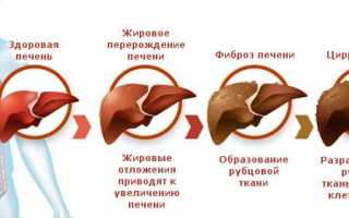 Фиброз печени 4 степени