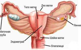 Рак матки: первые признаки и симптомы, диагностика, лечение, выживаемость