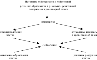 Белокровие: особенности патологии «белой» крови