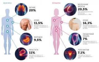 Заразен ли рак: раскапываем почву онкомифов