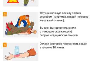 ПЕРВАЯ ПОМОЩЬ ПРИ ТЕРМИЧЕСКИХ ОЖОГАХ