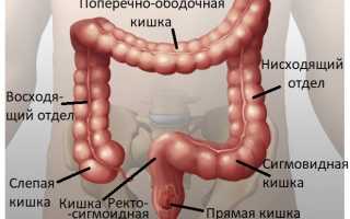 Вся правда о раке ободочной кишки: знай каждый!