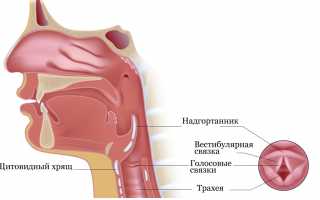 А как бывает с раком горла, или как не потерять голос?