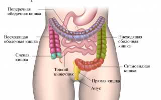 Рак тонкого кишечника: характер проявления и лечение патологии