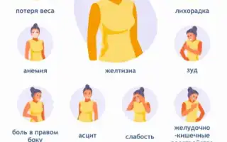 Симптомы цирроза печени