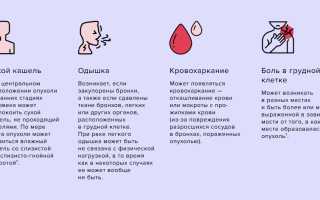 Плоскоклеточный рак легкого: виды и особенности патологии