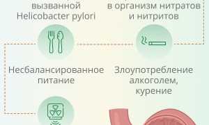 Может ли язва перерасти в рак и другие предпосылки рака желудка