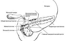 Взвесь в желчном пузыре