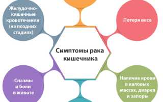 Всё про рак кишечника: первые симптомы, диагностика, стадии, выживаемость