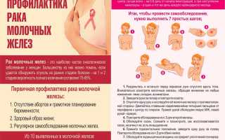 Профилактика рака молочной железы: памятка для женщин