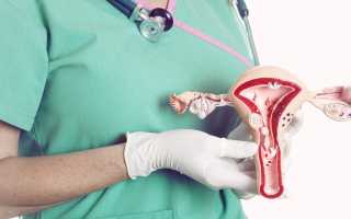 ЛЕЧЕНИЕ МИОМЫ С ПОМОЩЬЮ ФИТОТЕРАПИИ