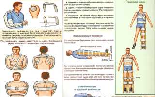 ПРАВИЛЬНОЕ ОБРАЩЕНИЕ С ПОСТРАДАВШИМИ. ИММОБИЛИЗАЦИЯ