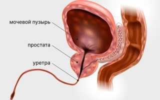 Разбор онкомаркера ПСА – специально для простаты