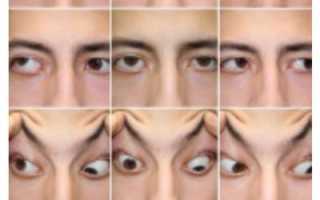 ЗАБОЛЕВАНИЯ ГЛАЗНИЦЫ