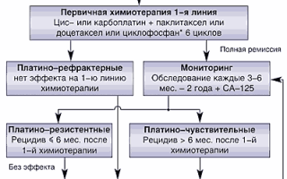 Разбираем методы лечения онкологии: Химиотерапия