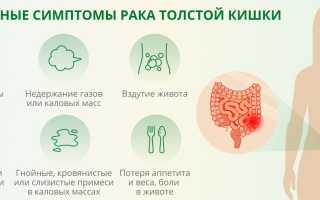 Рак прямой кишки: первые симптомы и признаки, диагностика, методы лечения