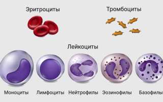 Острый лейкоз: главные особенности разновидности белокровия
