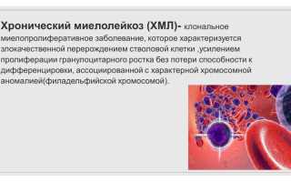 Гость рубрики: хронический миелолейкоз