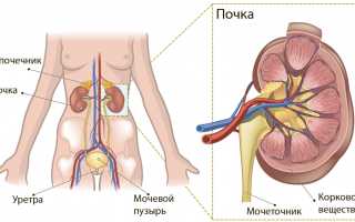 Эти страшные почки: когда рак добирается и до них