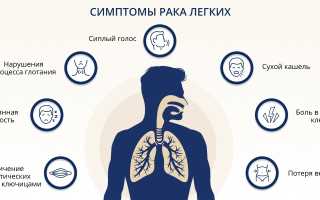 Поговорим открыто про признаки рака: знай и поделись с другими