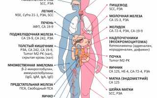 Анализ крови на онкомаркеры: все виды по областям, нормы, рекомендации