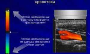 Виден ли фиброз печени на узи