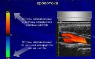 Виден ли фиброз печени на узи