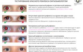 Ретинобластома у детей: признаки, стадии, диагностика, прогноз