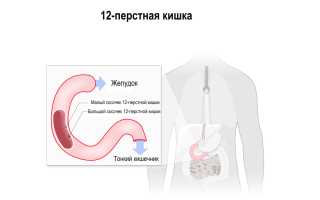Рак двенадцатиперстной кишки: это должен знать каждый