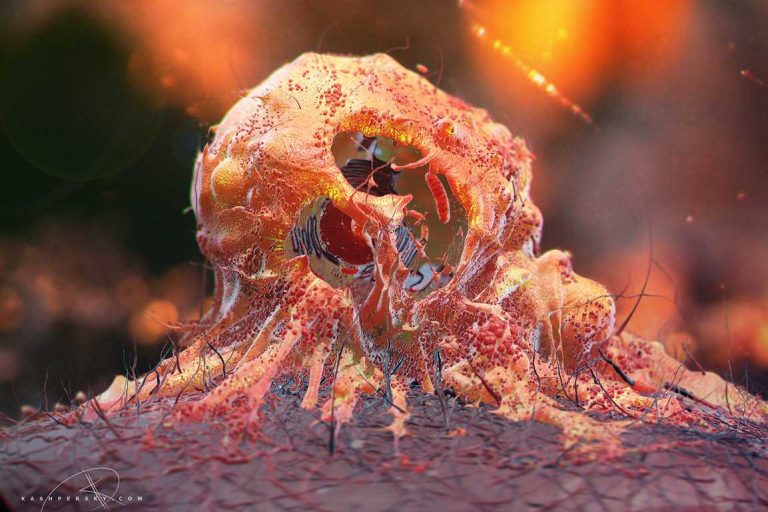 Раковая клетка Раковая клетка