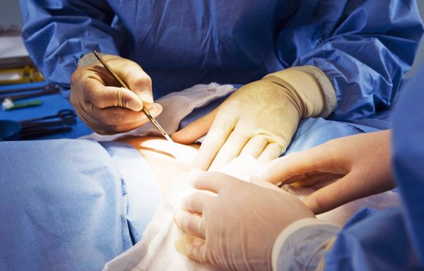 хирургическая операция хирургическая операция