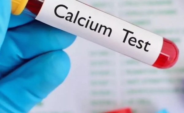 Кальций в крови Кальций в крови
