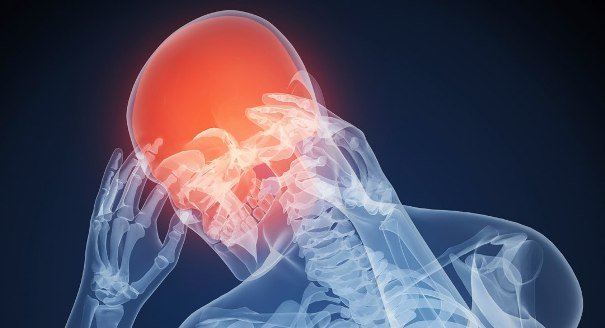 Постоянные головные боли Постоянные головные боли