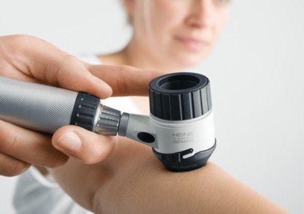 Дерматоскоп фото Дерматоскоп фото