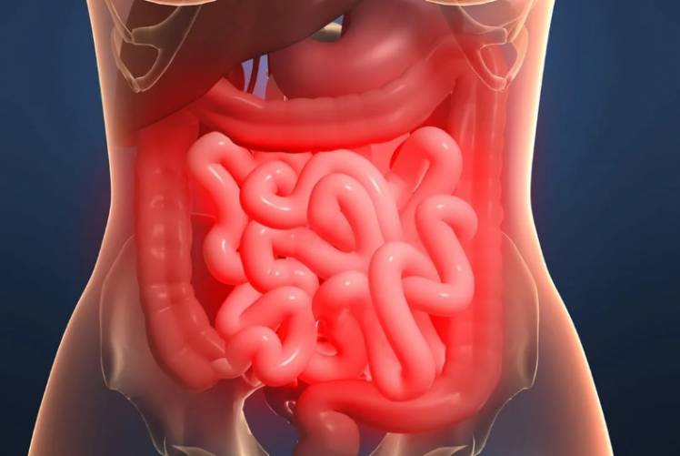 Боли в кишечнике Боли в кишечнике