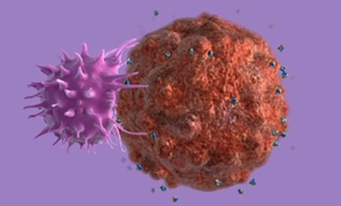 Малигнизация Малигнизация