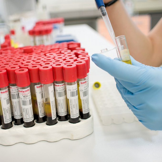 исследование крови исследование крови