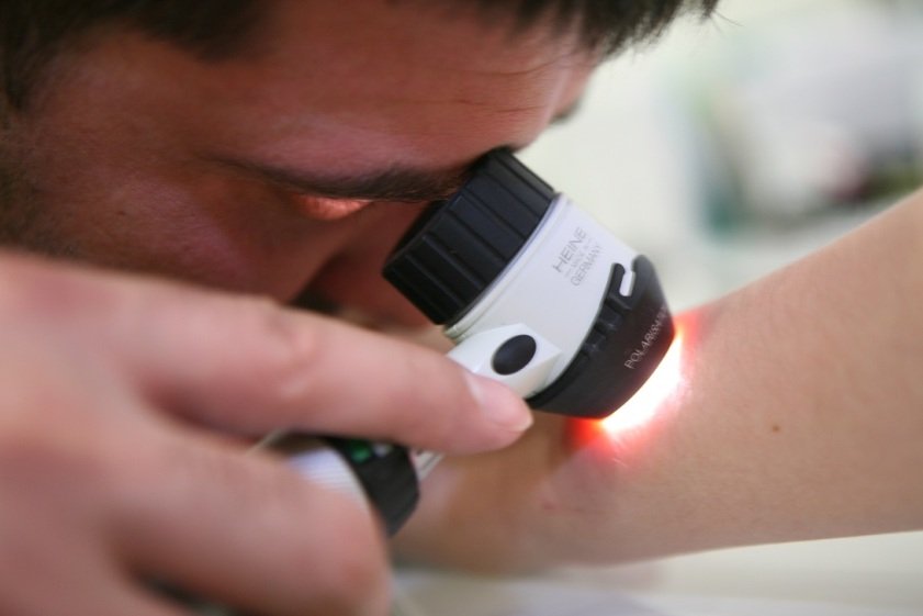 Дерматоскопия Дерматоскопия