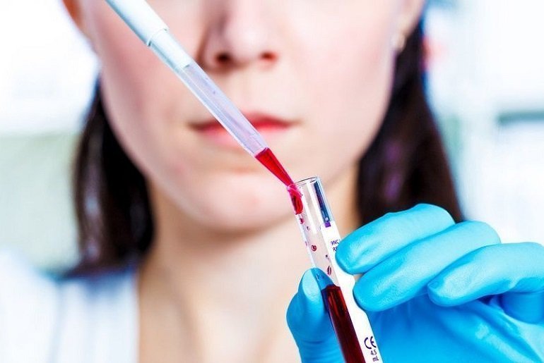 исследование крови исследование крови