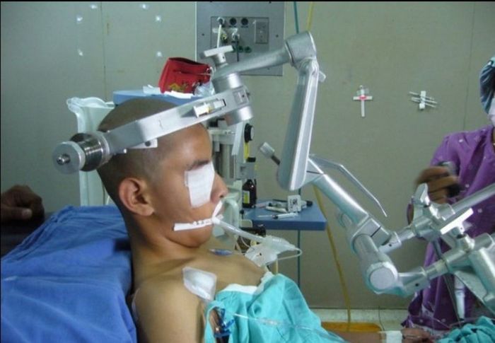 Операция на мозге