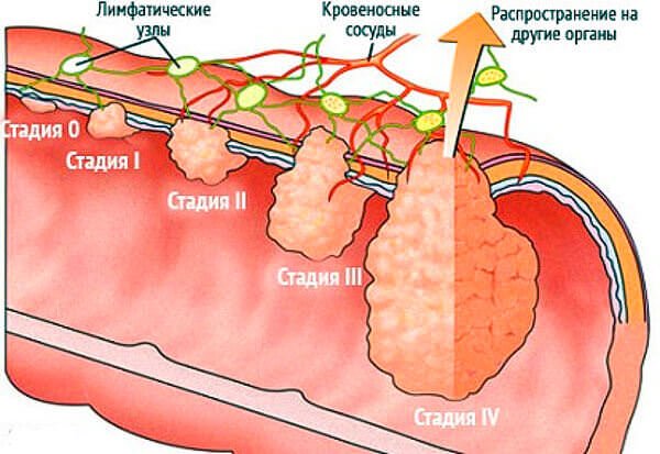 Стадии Стадии