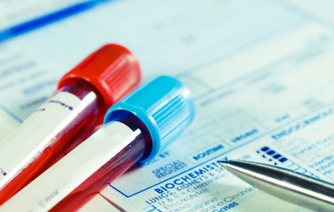 рэа анализ крови рэа анализ крови