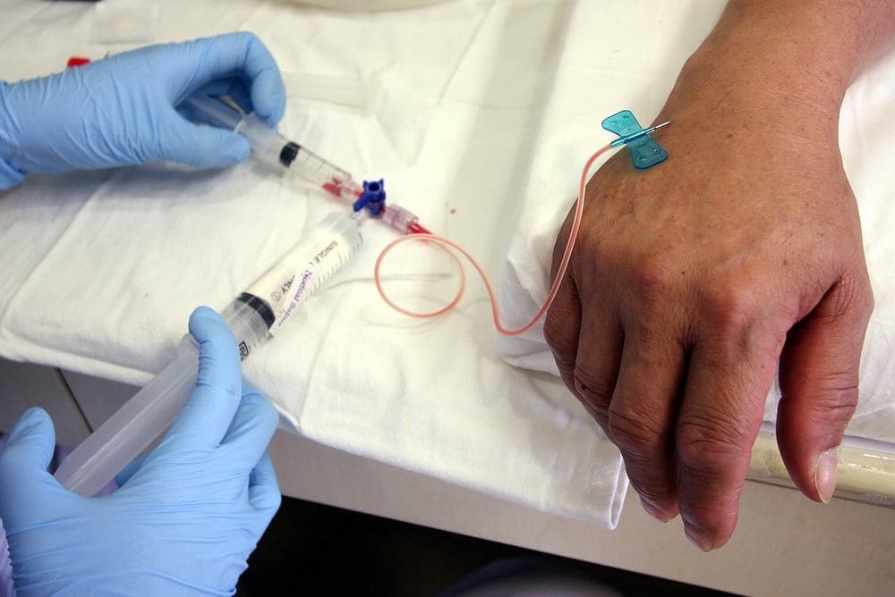 химиотерапия