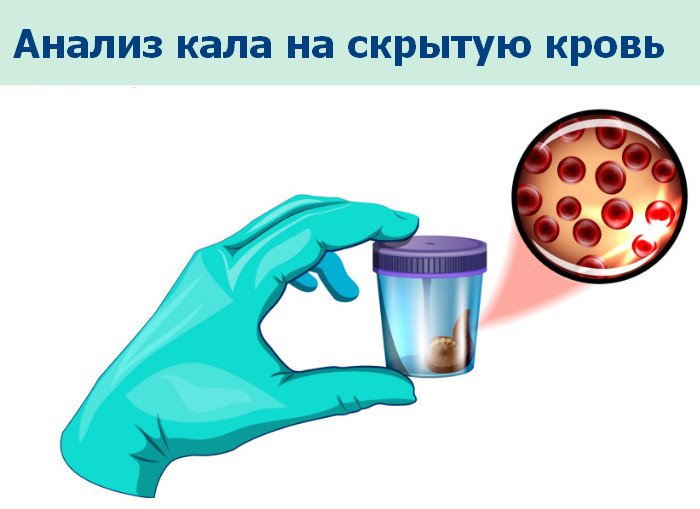 Анализ кала на скрытую кровь Анализ кала на скрытую кровь