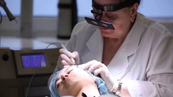 Криокоагуляция Криокоагуляция