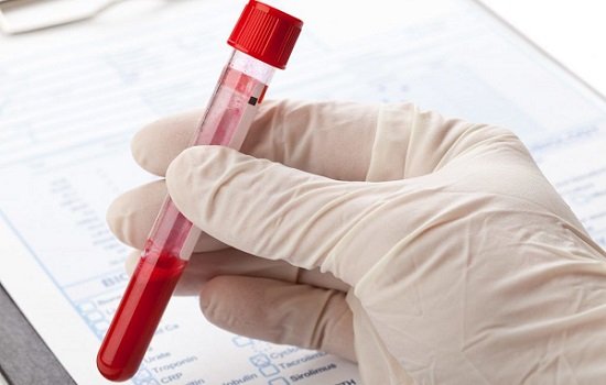 анализ крови - диагностика лимфолейкоза