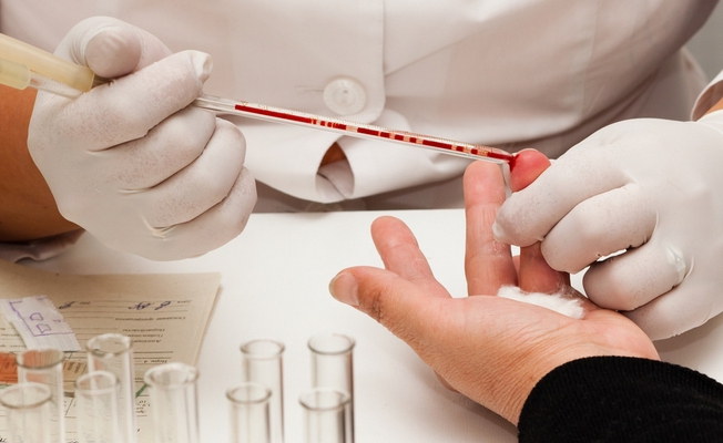 общий анализ крови общий анализ крови