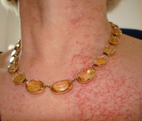 Побочный эффект Побочный эффект